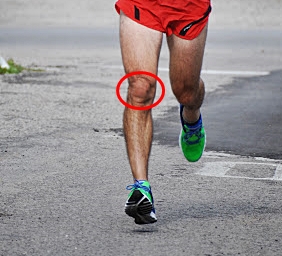 Treatment of Shin Splints in Runners