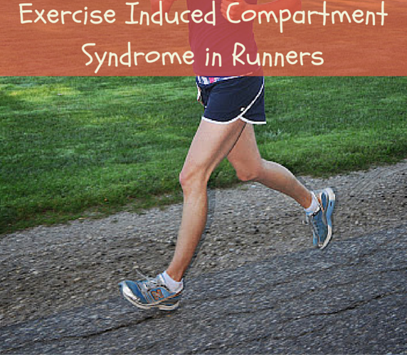 Exercise Induced Compartment Syndrome 