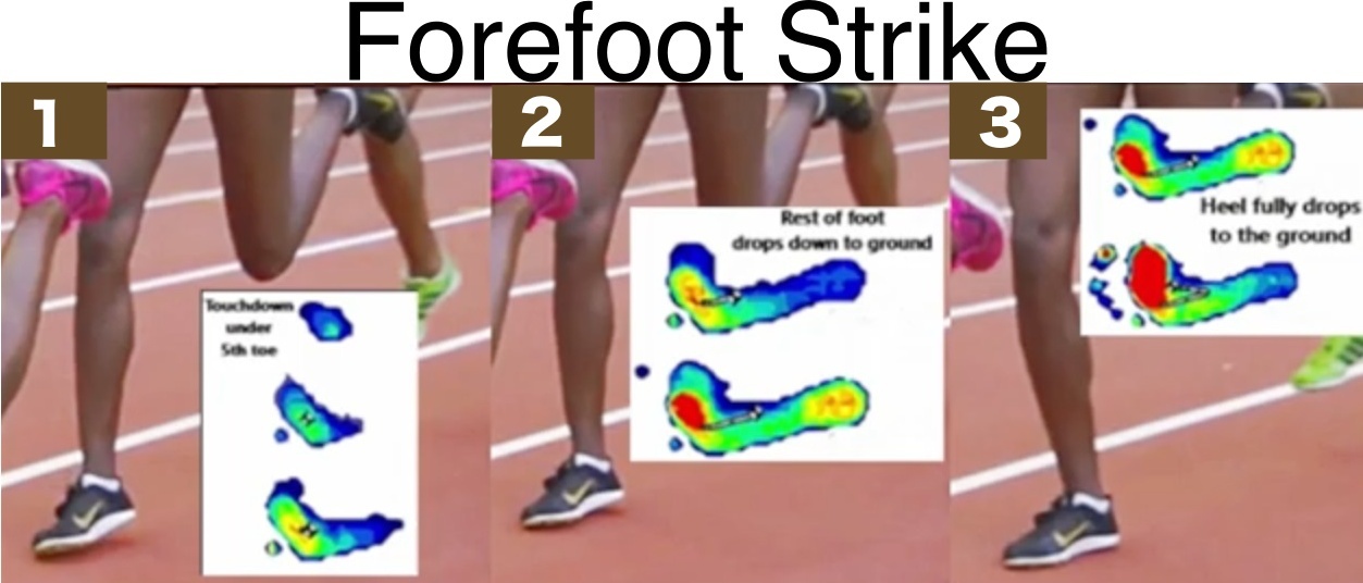 Forefoot Running is Better for Higher Arches than Heel Strike Running