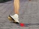 Heel Strike Running is Bad for Runners with High Arches