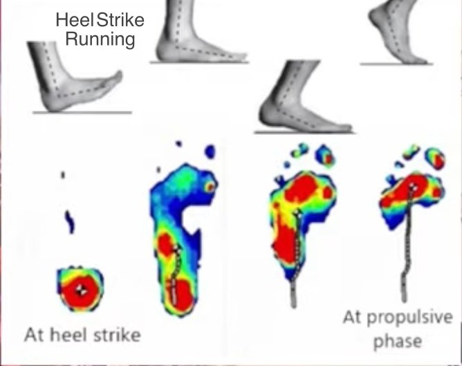 Why Heel Strike Running is Bad for High Arches