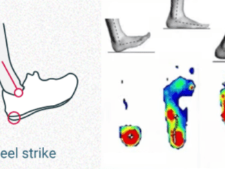 Heel Strike Running Causes Overpronation of the Foot