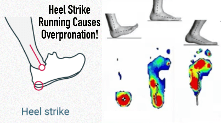 Heel Strike Running Causes Over-pronation