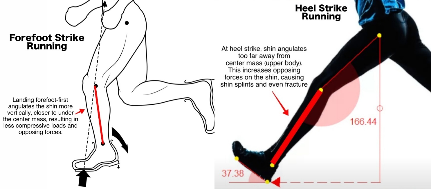 Why Heel Strike Running is Bad for the Shins