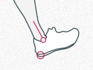 Does Heel Striking Cause Shin Splints?